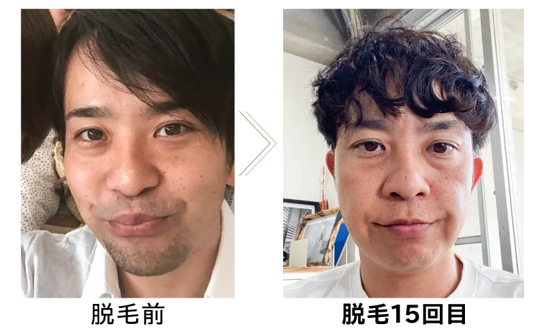 ビフォー・アフター画像